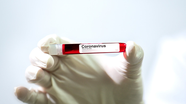 Araştırmacılar, Bir Hastada İki Farklı Koronavirüs Türü Tespit Ettiler