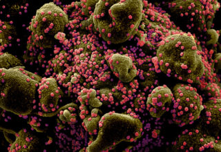 Bilim Kurulu Üyesi: “Ülkemize Has Koronavirüs Mutasyonları Var”