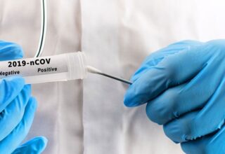 Doç. Dr. Ümit Savaşçı: Koronavirüs Temaslıları, PCR Testini En Erken 3 Gün Sonra Yaptırmalı