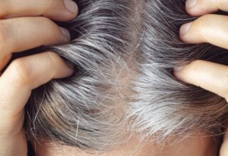 Stresin Saç Beyazlamasına Sebep Olduğu Doğrulandı: Geri Döndürülebiliyor