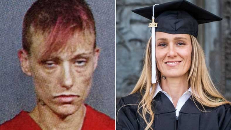 Uyuşturucu Bağımlılığından Kurtulup Üniversite Mezunu Olan Kadının Viral Olan 'Öncesi ve Sonrası' Fotoğrafı