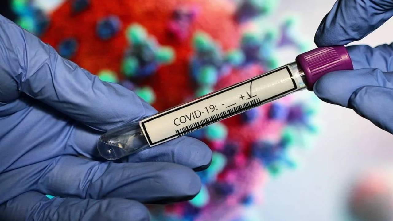 koronavirüs testi