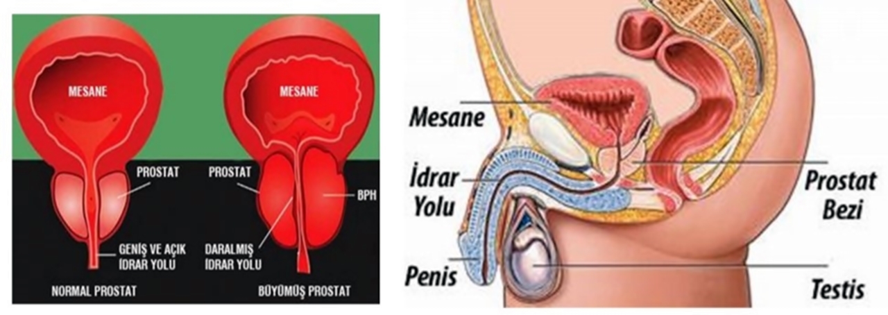 erkek prostat